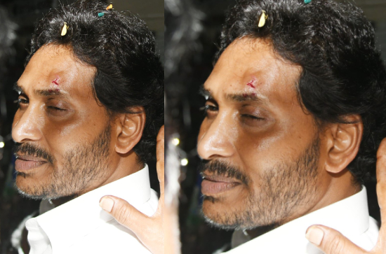 CM Jagan attacked during Memantha Siddham Yatra in Vijayawada